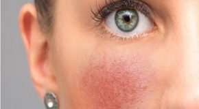 Cosmétiques : les ingrédients incompatibles avec le soleil